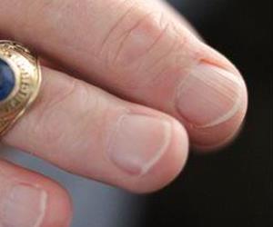 Finger length may be telling.